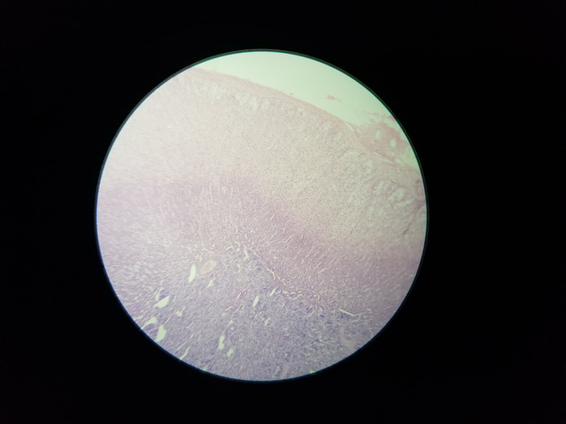 Adrenal Slides - Adrenal 006 100X